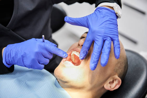 Best Emergency Treatment for Oral Infections in Canfield, OH